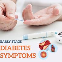 مجموعه داده‌ی تشخیص ریسک دیابت در مراحل اولیه (Early Stage Diabetes)