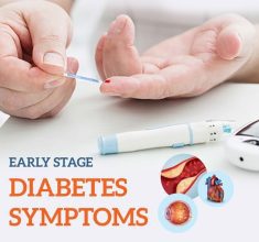 مجموعه داده‌ی تشخیص ریسک دیابت در مراحل اولیه (Early Stage Diabetes)